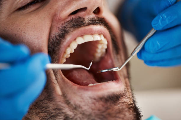 Best Emergency Dentist for Knocked-Out Tooth in Horton, KS